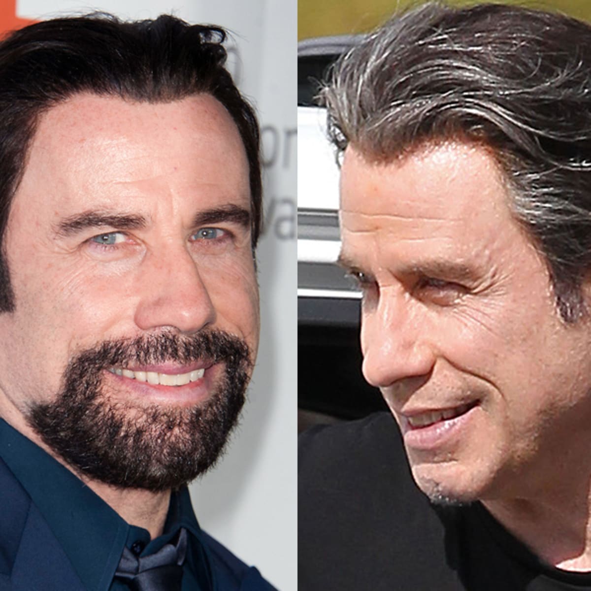 John Travoltas EverChanging Hair Through the Years Photos