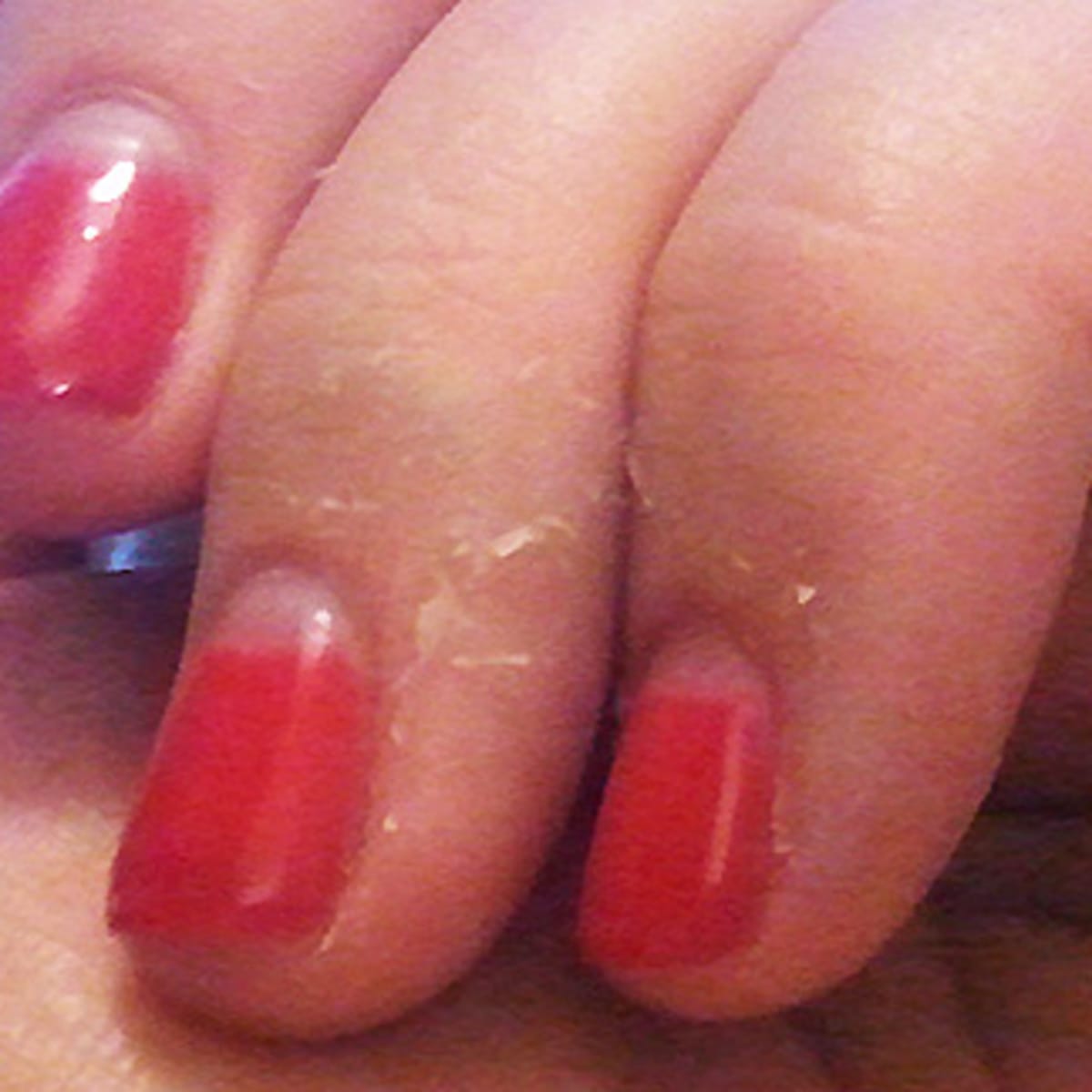 Skin Shock What Happened When I Soaked Off My Soak Off Mani Myself Beautygeeks