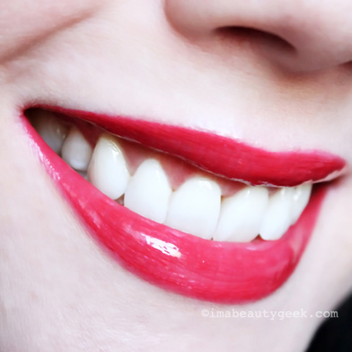 sonicare before and after