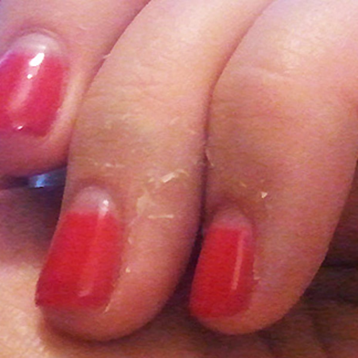 Getting nail polish sales off skin