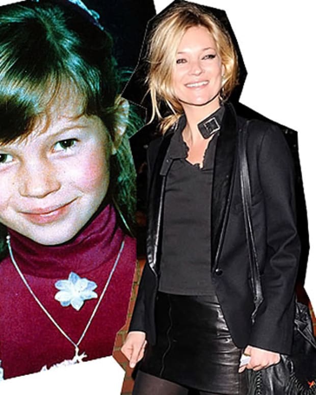 Kate Moss before and after