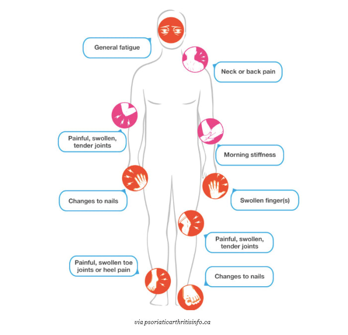 PSORIATIC ARTHRITIS (PsA) AND WHY WE NEED TO KEEP TALKING ABOUT IT ...