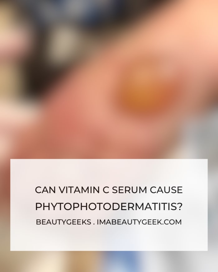 can-vitamin-c-skincare-cause-phytophotodermatitis-beautygeeks