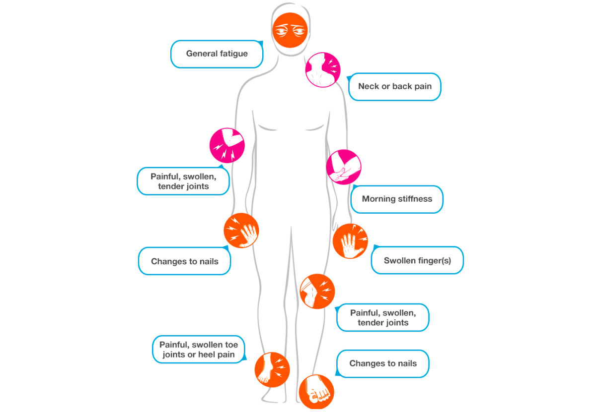 What Causes Psoriatic Arthritis